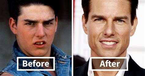 Viralitytoday 14 Incredible Before And After