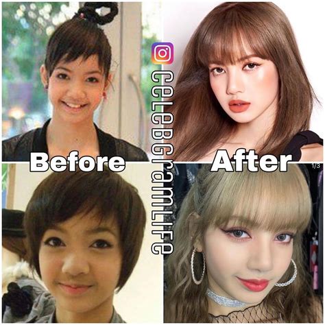 blackpink  plastic surgery  korea