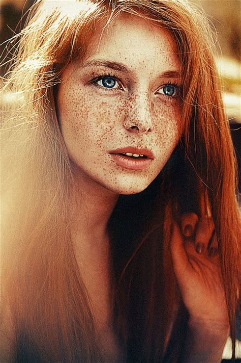 pin on freckles