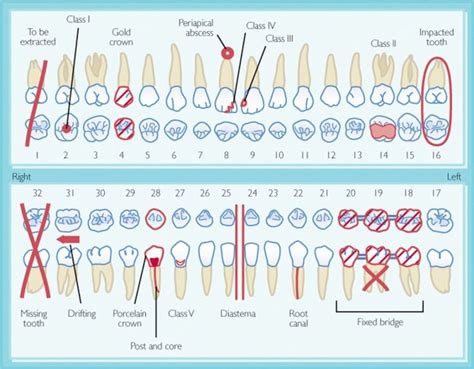 dental charting dental hygiene school dental hygiene student