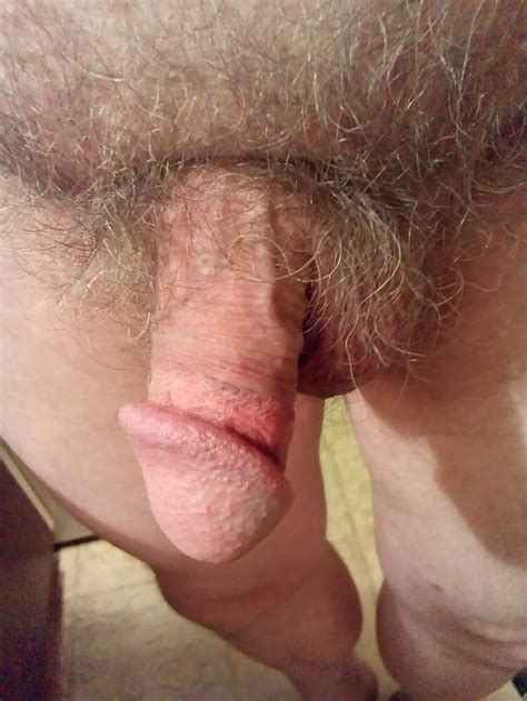 my small hairy cock 9 pics xhamster