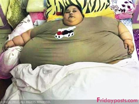 World’s Fattest Woman Sheds 323kg Fridayposts