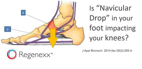Foot Arch Knee Pain Research Links Your Foot Navicular