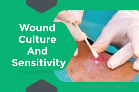 wound culture  sensitivity