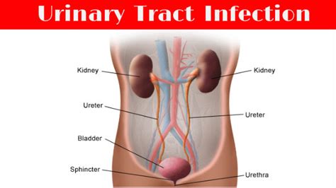 urinary tract infections sex nude photos