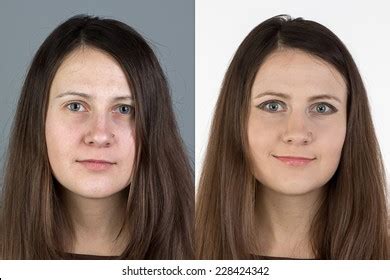 young woman   cosmetic procedure stock photo