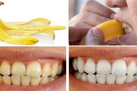 inilah  memutihkan gigi  kulit pisang secara alami  cepat