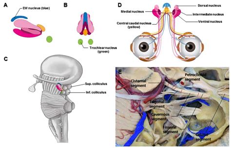 oculomotor nerve  neurosurgical atlas