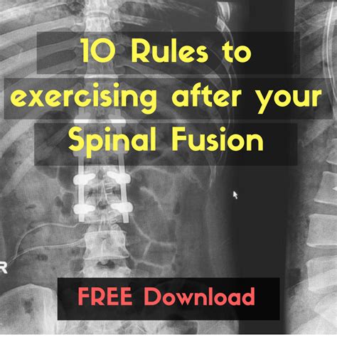 The Do S And Don Ts Of Exercising After A Spinal Fusion