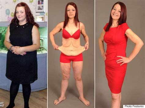 Bride Left With Excess Skin After Losing 9 Stone For