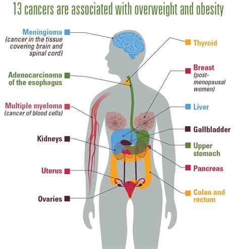 overweight obesity leading cancer risk factor