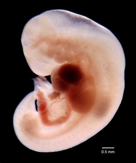 medical school human embryo  carnagie stage  day