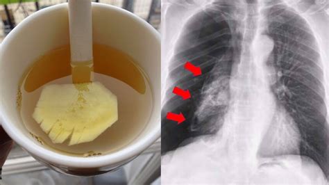 natural remedy  clean lungs  smoking   clean lungs