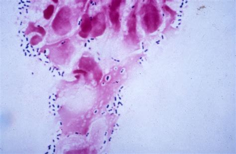 Streptococcus Junglekey Fr Image 100