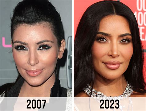 fans think kim kardashian is lying about having plastic surgery