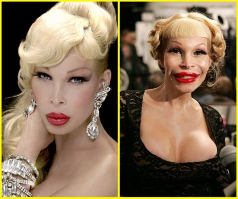 model amanda lepore plastic surgery before and after photo