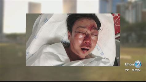 arrest made after brutal beating of two japanese tourists in kakaako makes news headlines in