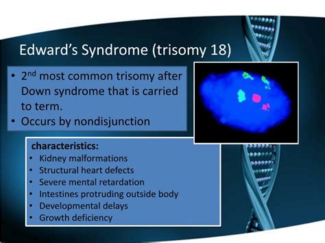 Ppt Numerical Chromosome Abnormalities Powerpoint Presentation Free