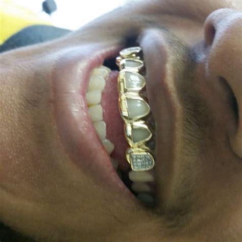 ct real gold grillz