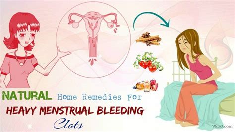 44 natural home remedies for heavy menstrual bleeding clots