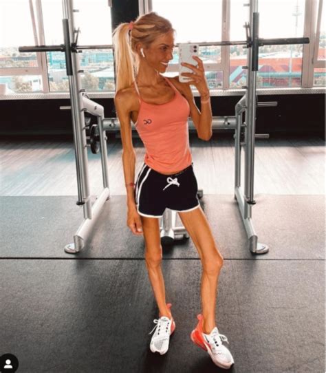 Josi Maria Death German Instagram Model Battled Anorexia Eating Issues
