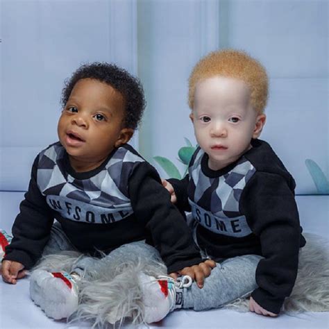 Rare Nigerian Twins Look Nothing Like Each Other As Both Are Born With