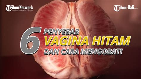 6 Penyebab Vagina Hitam Termasuk Akibat Gesekan Youtube