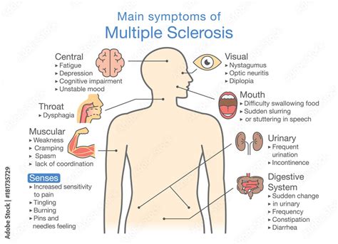 main symptoms  multiple sclerosis illustration  medical diagram  health check