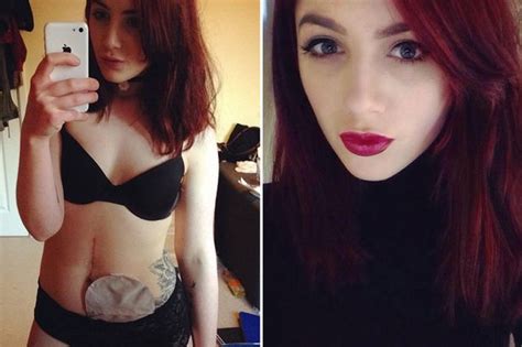 selfies sex and bikinis meet the brave girl enjoying a normal teenager s life despite having