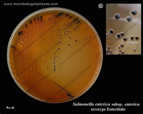 salmonella colonies  emb  shigella  salmonella colonies
