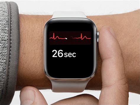 How To Share An Ecg From Your Apple Watch With Your Doctor