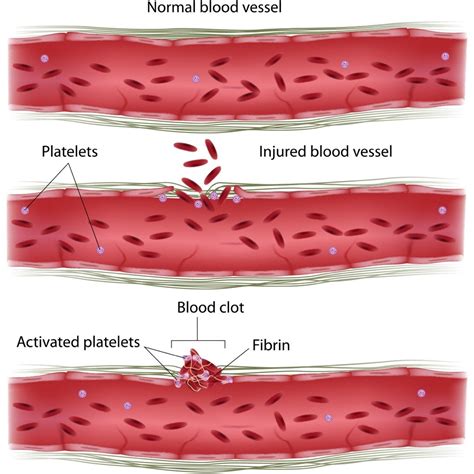 blood clotting anatomy ch  blood
