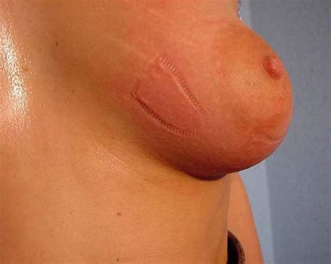 femdom wrestling bdsm pic breast torture and torture penis methods