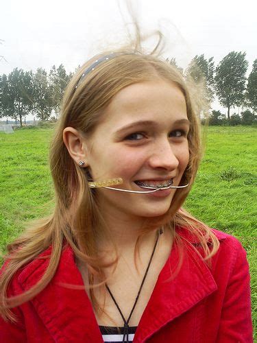 braces girlswithbraces metalbraces headgear