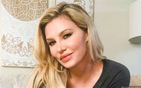 brandi glanville shares graphic pic of her burned face to fight back