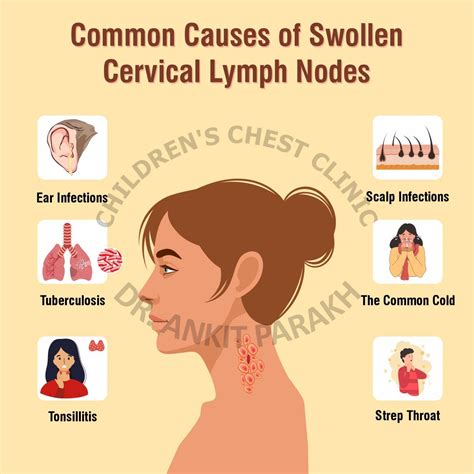 common   enlarged cervical lymph nodes  children