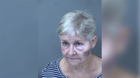 Police 71 Year Old Woman Accused Of Beating Husband Was ‘tired Of
