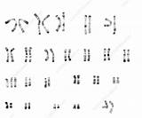 Trisomy 13 Karyotype Female Science sketch template