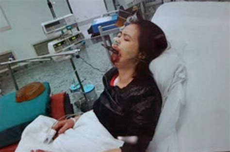Chinese Woman Stuffs Chopsticks Down Throat After Allergic Reaction