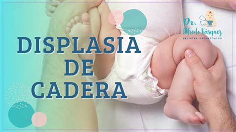 Displasia De Cadera En BebÉs Pediatra NeonatÓlogo Cómo Detectar