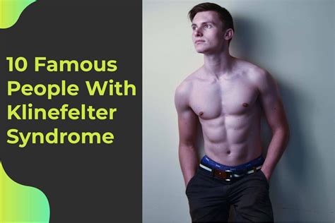 10 Famous People With Klinefelter Syndrome Number 1 And 7 Free