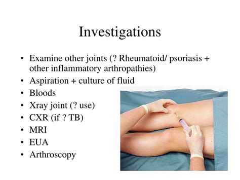 ppt knee examination powerpoint presentation free download id 5175949