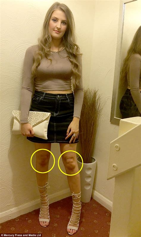this woman claims her left knee looks like james corden