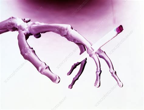 hand of skeleton holding a smoking cigarette stock image m370 0629