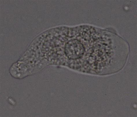 naked amoebae protists in singapore