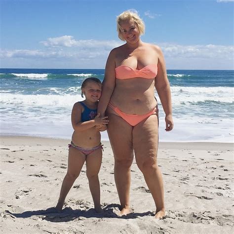 woman calls stretch marks glitter stripes in viral body confidence post fox news