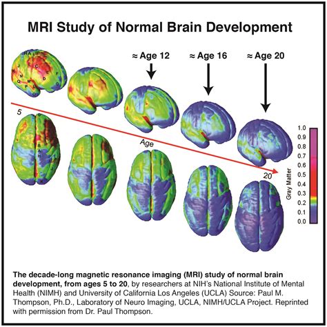 substance  disorder  brain development pacesconnection