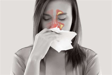 sinus headache signs symptoms  treatment options