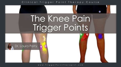 knee pain trigger points youtube