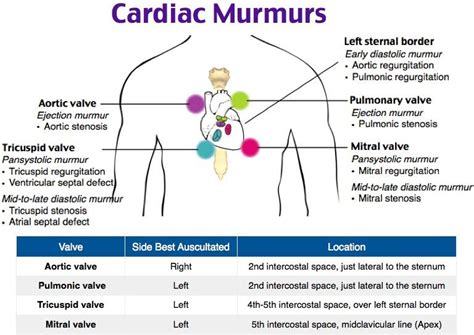 Image Gallery Heart Murmur Locations Pediatric Nursing
